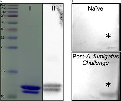 Vaccine-Induced Protection in Two Murine Models of Invasive Pulmonary Aspergillosis